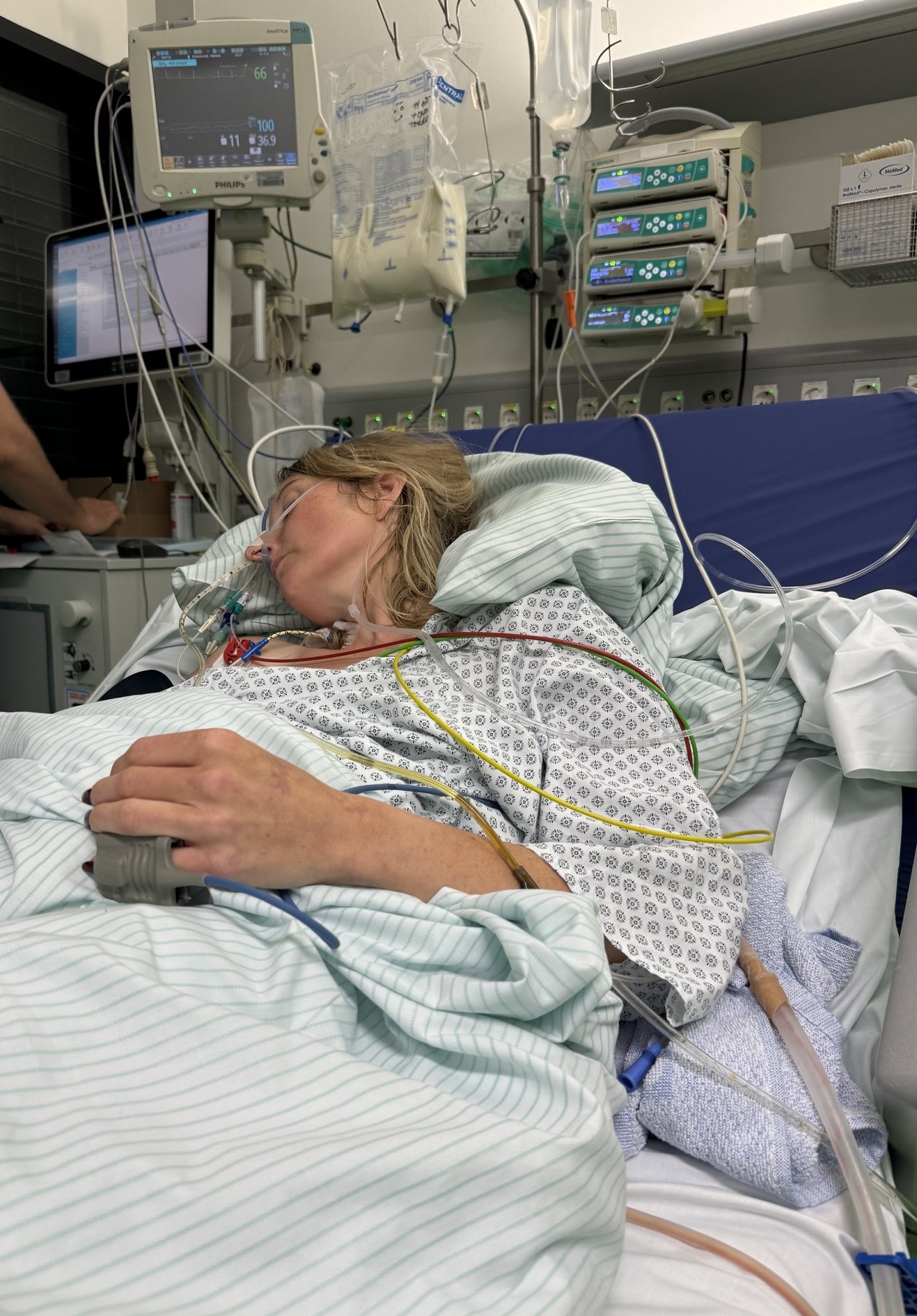 Nach der Operation lag Melanie Groenewold auf der Intensivstation, angeschlossen an Monitore und Infusionen. (c) Melanie Groenewold